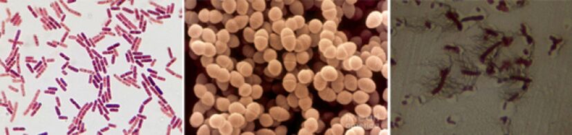Escherichia Sticks, Fecal Enterococcus და Pro - ქრონიკული ბაქტერიული პროსტატიტის მთავარი პათოგენები